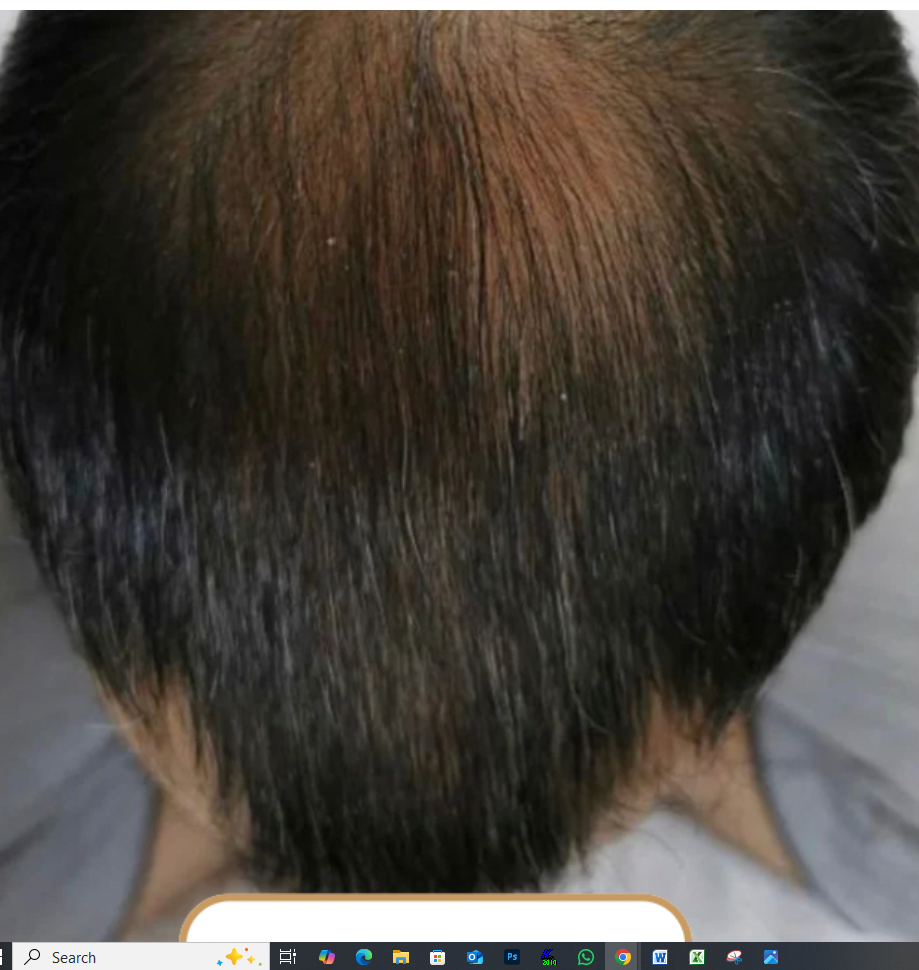 3 زيت ترميم الشعر الطبيعي – تغذية من الجذور حتى الأطراف - الصورة 3