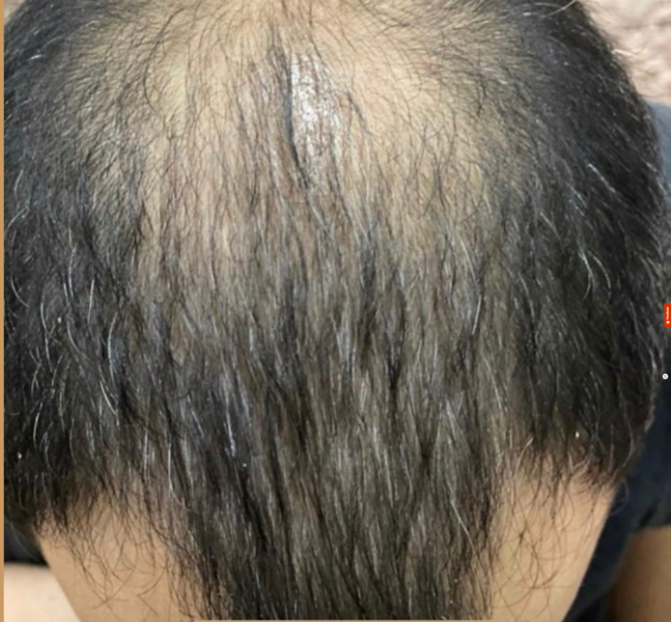 4 زيت ترميم الشعر الطبيعي – تغذية من الجذور حتى الأطراف - الصورة 4